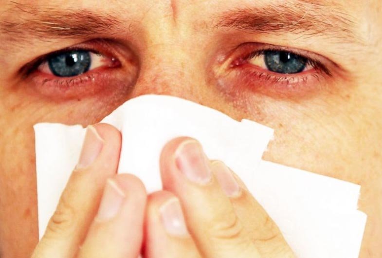 Síntomas de la Alergia y como tratarlos